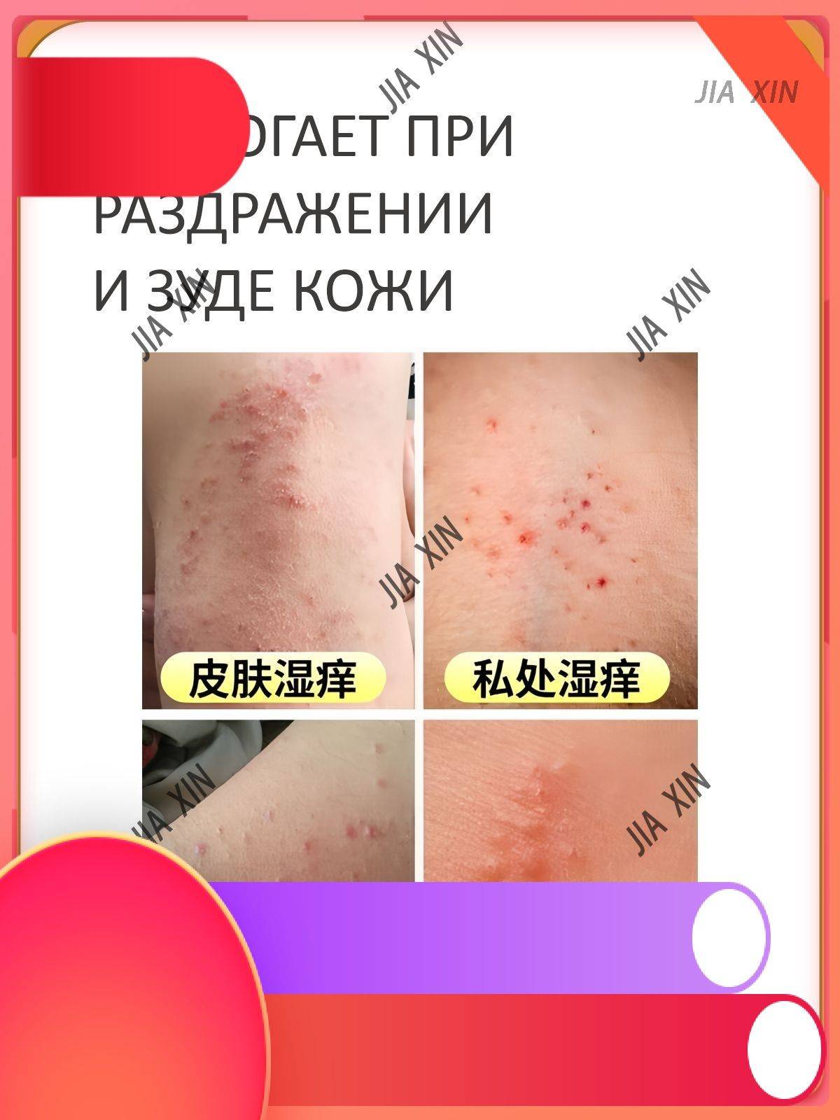 Ansin Ointment 20 ml Transparent for Dermatitis and Skin Irritation #4
