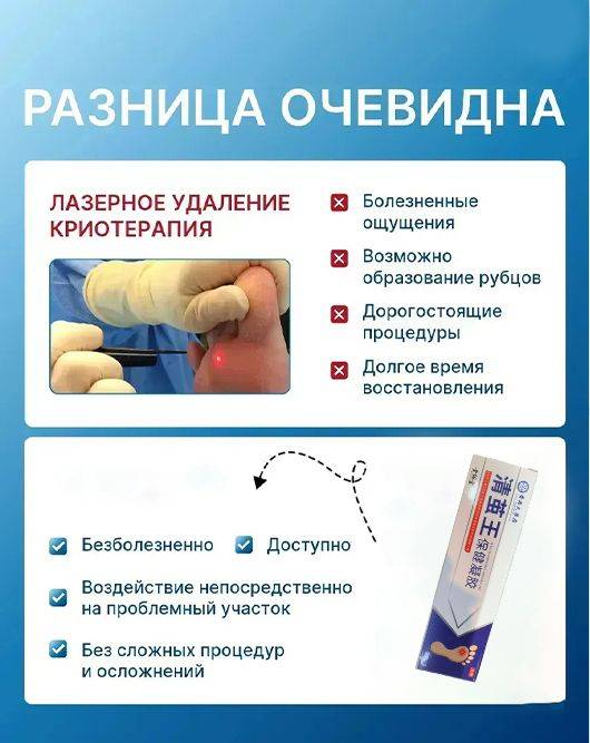 Kornex Corn and Callus Remedy Ointment and Gel 20 ml #5