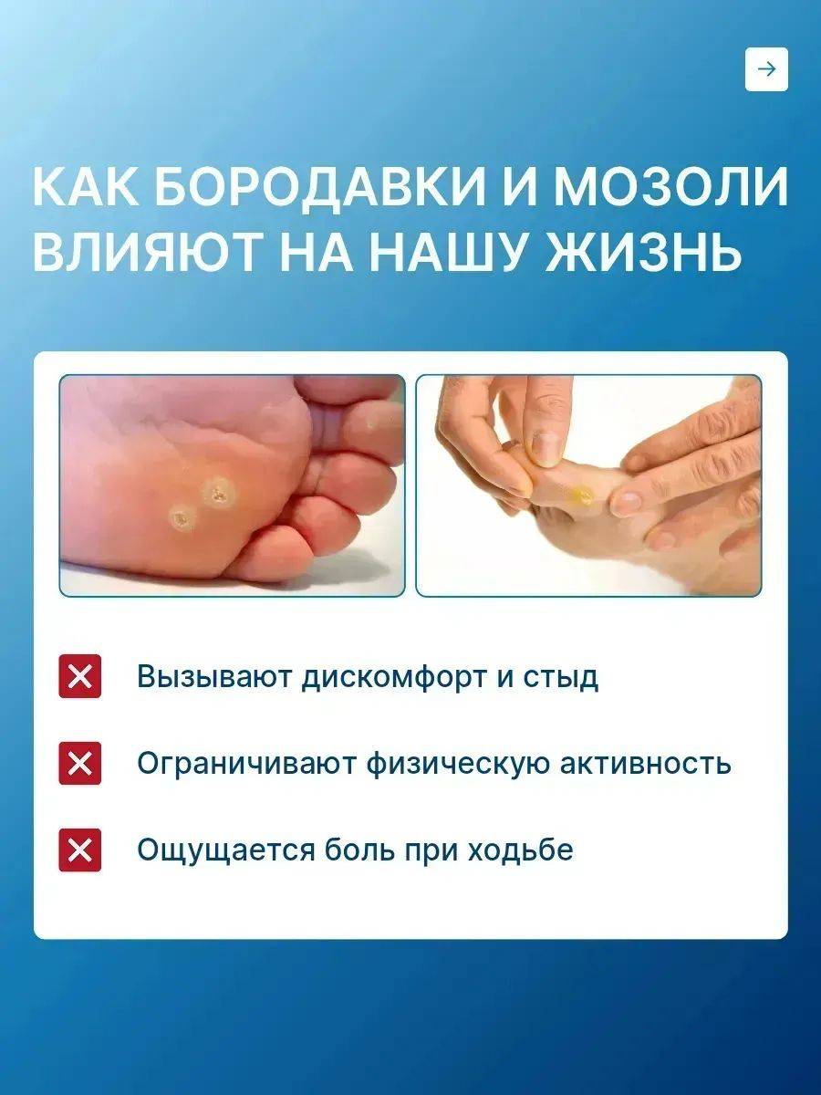 Kornex Corn and Callus Remedy Ointment and Gel 20 ml #6