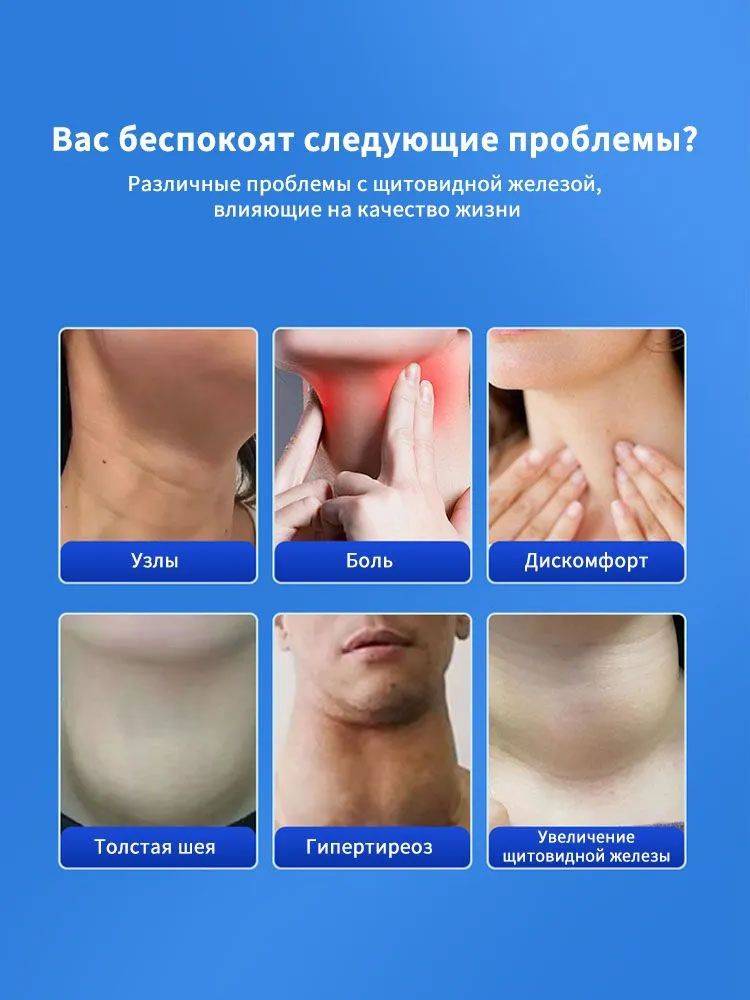 Thyroid therapeutic agent 30 g topical formula #2