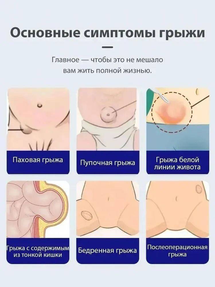 Inguinal Hernia Support Patch – 10-Pack for Pain Relief and Comfort #2