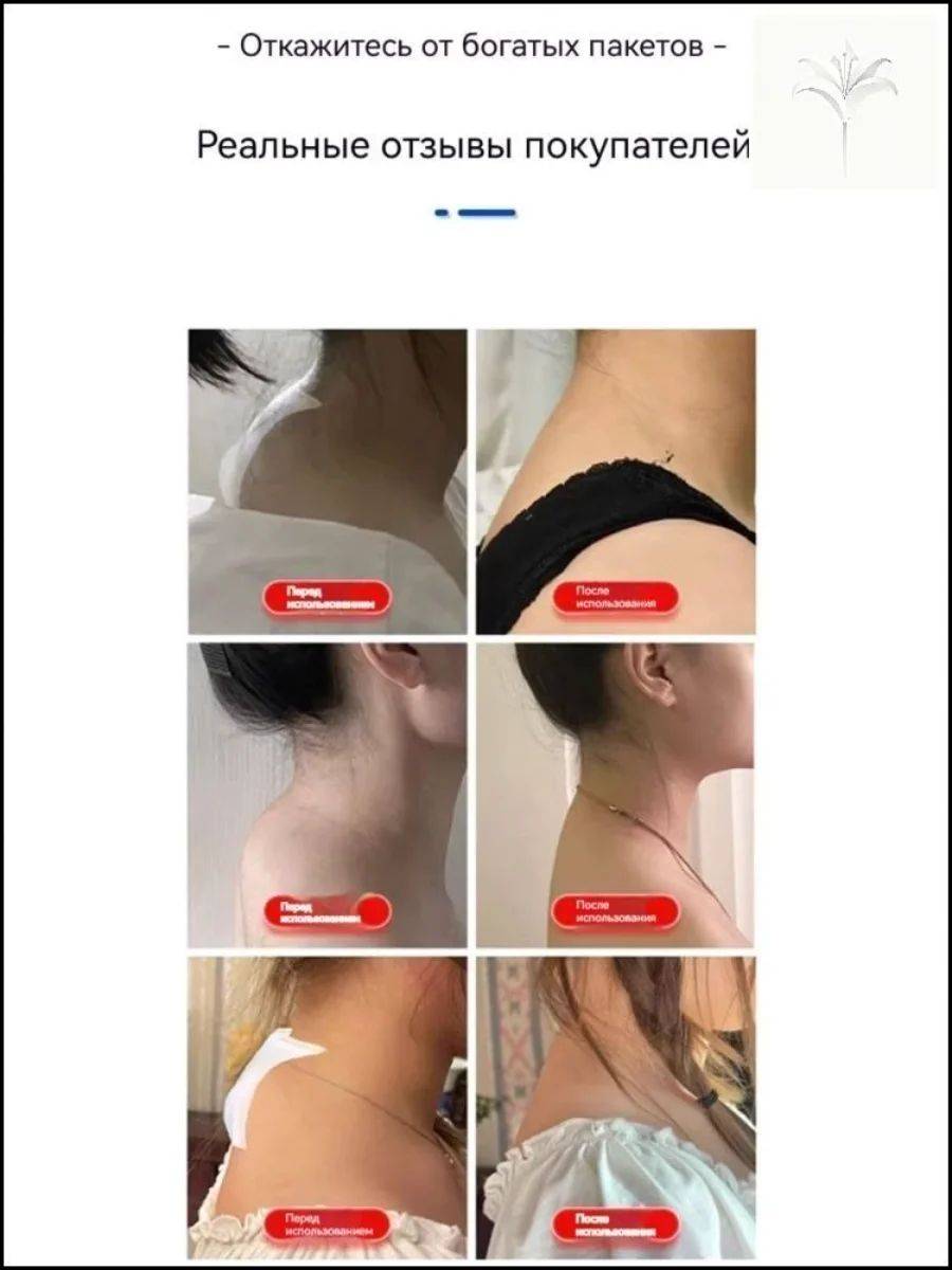 Exclusive Wart Patches for the Neck, 20 Units #3