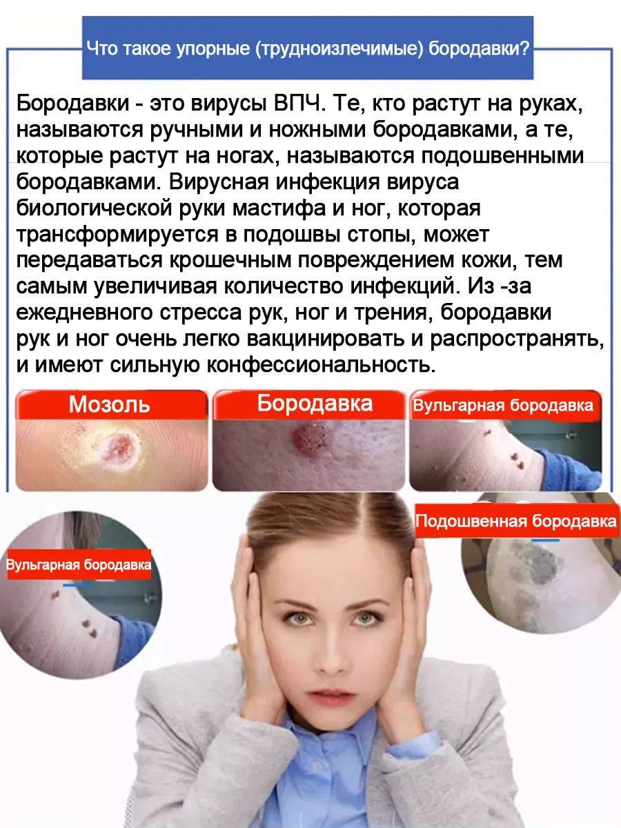 Collomak Wart and Papilloma Remover Cream – Painless, Fast-Acting Skin Treatment, 20ml #3