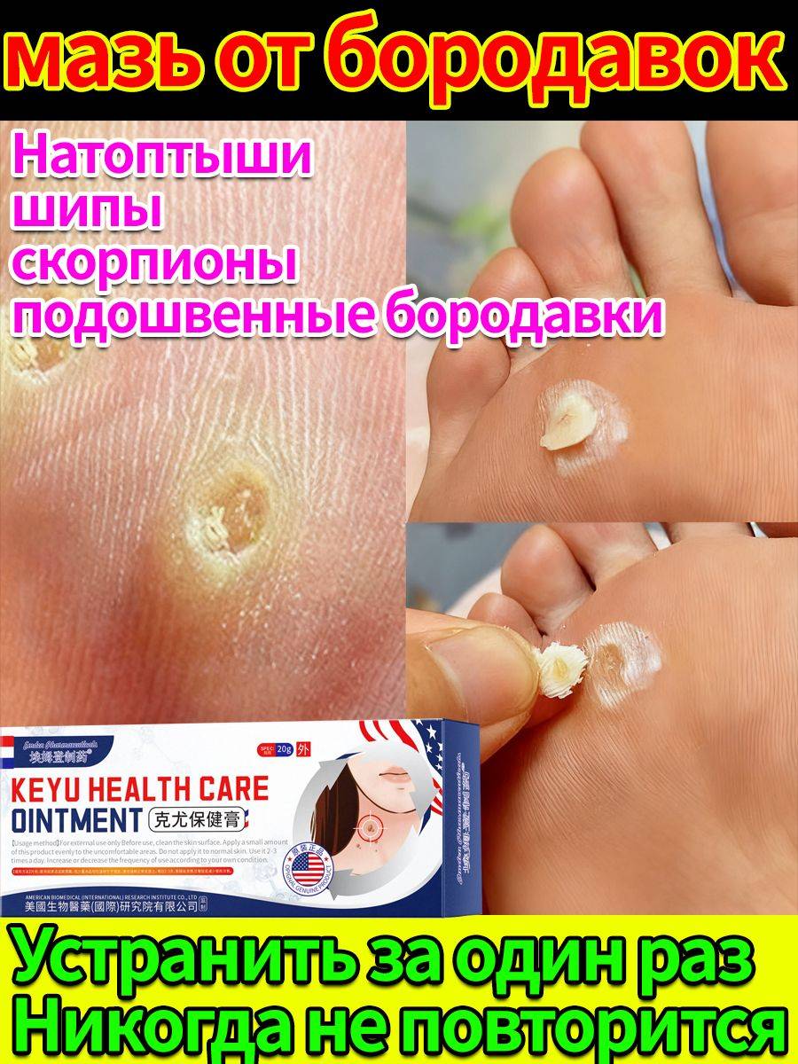 Foot Cream Balm for Corns and Calluses 60 ml Pack of 3