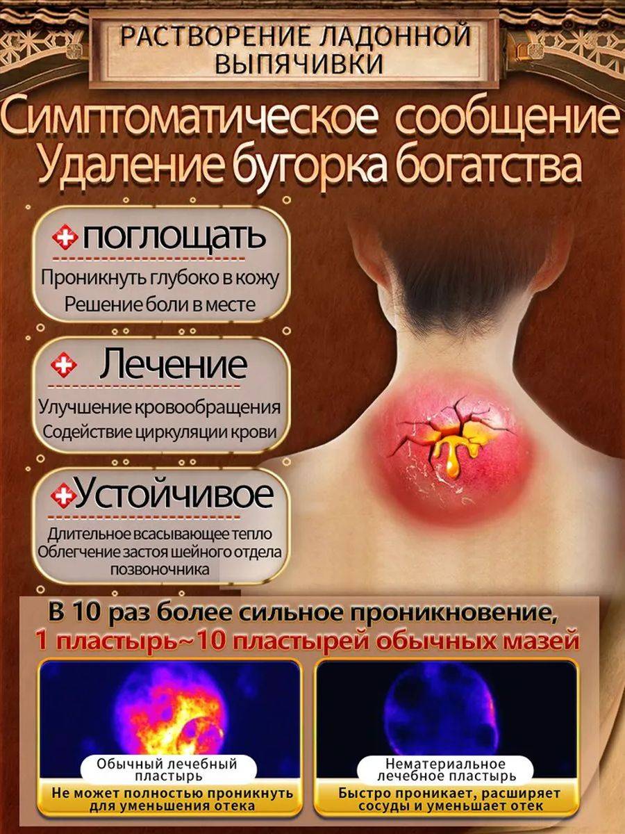 Neck Hump Relief Cream for Osteoarthritis and Back Pain, 20g #4