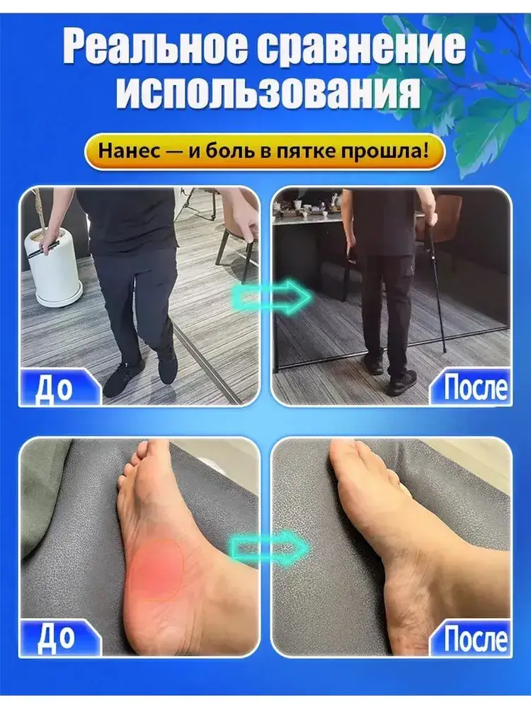 Medical Bile Ointment for Heel Spurs 55g #5