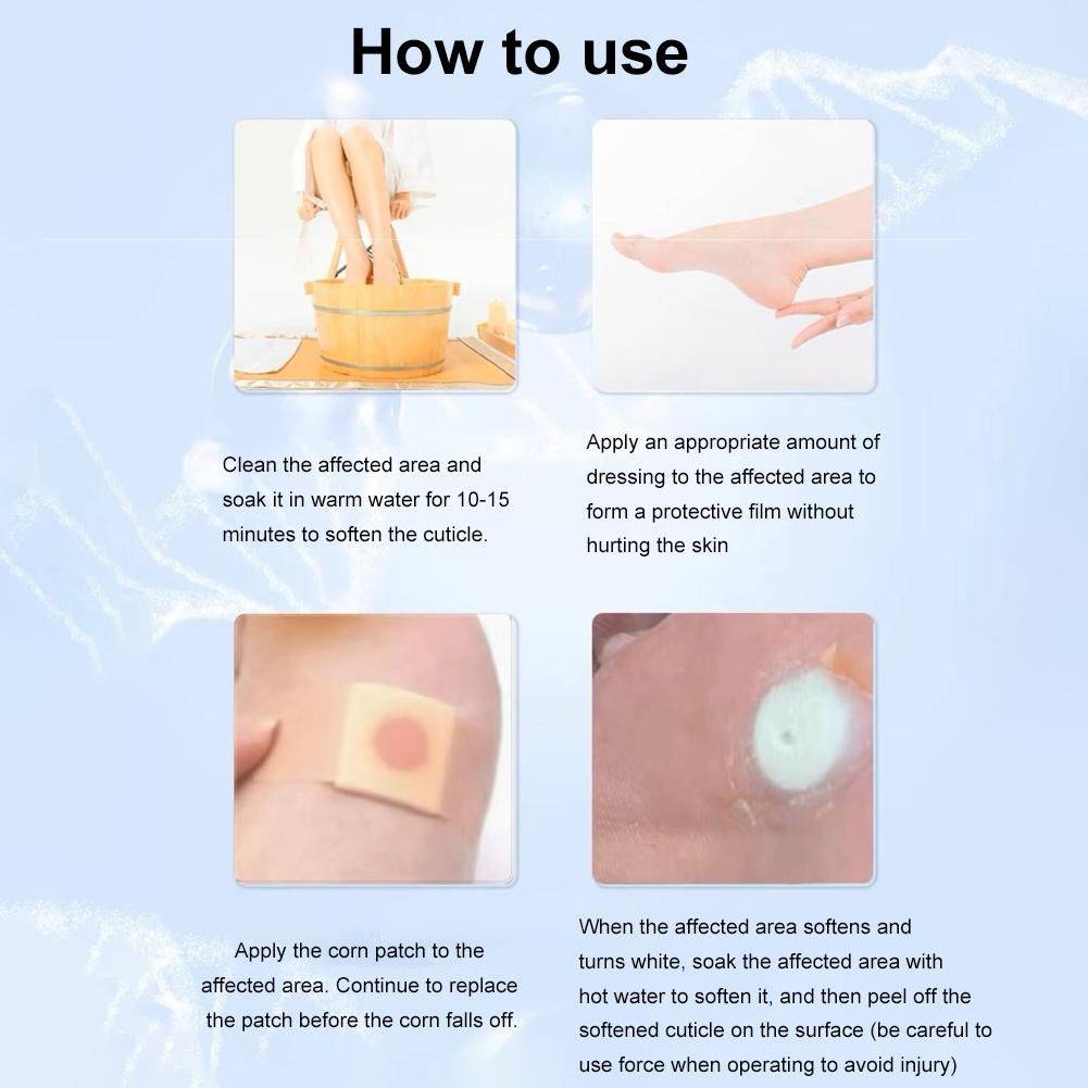 Foot Corn, Callus, and Plantar Wart Treatment #11
