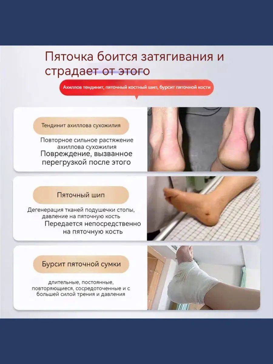 Brand Name 20 g Therapeutic Cream for Achilles Tendon Pain Relief #5