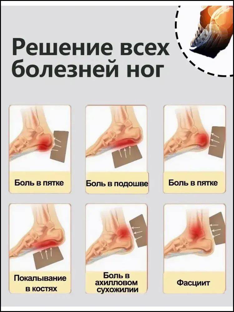 Heel Spur Pain Relief Patch with Natural Herbs – 12-Pack for Foot Pain, Plantar Fasciitis & Achilles Tendonitis #6