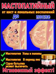 Natural Herbal Cream for Breast Care – 100% Plant‑Based, 9‑Herb Formula #1