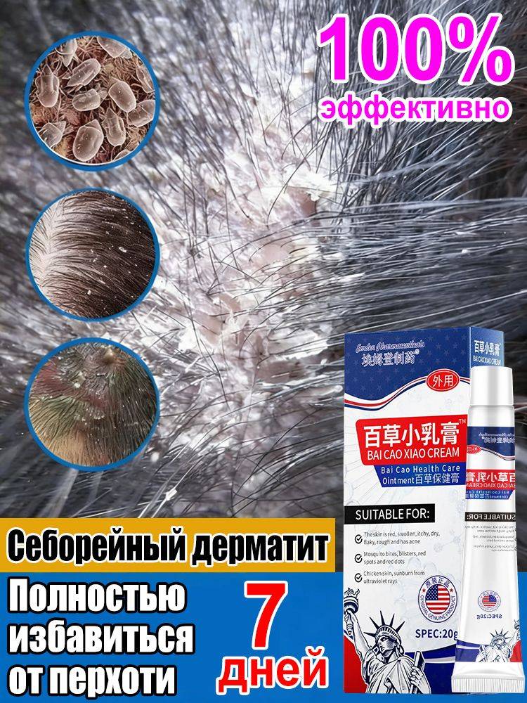 Antifungal Scalp Cream for Dermatitis, 20g Tube