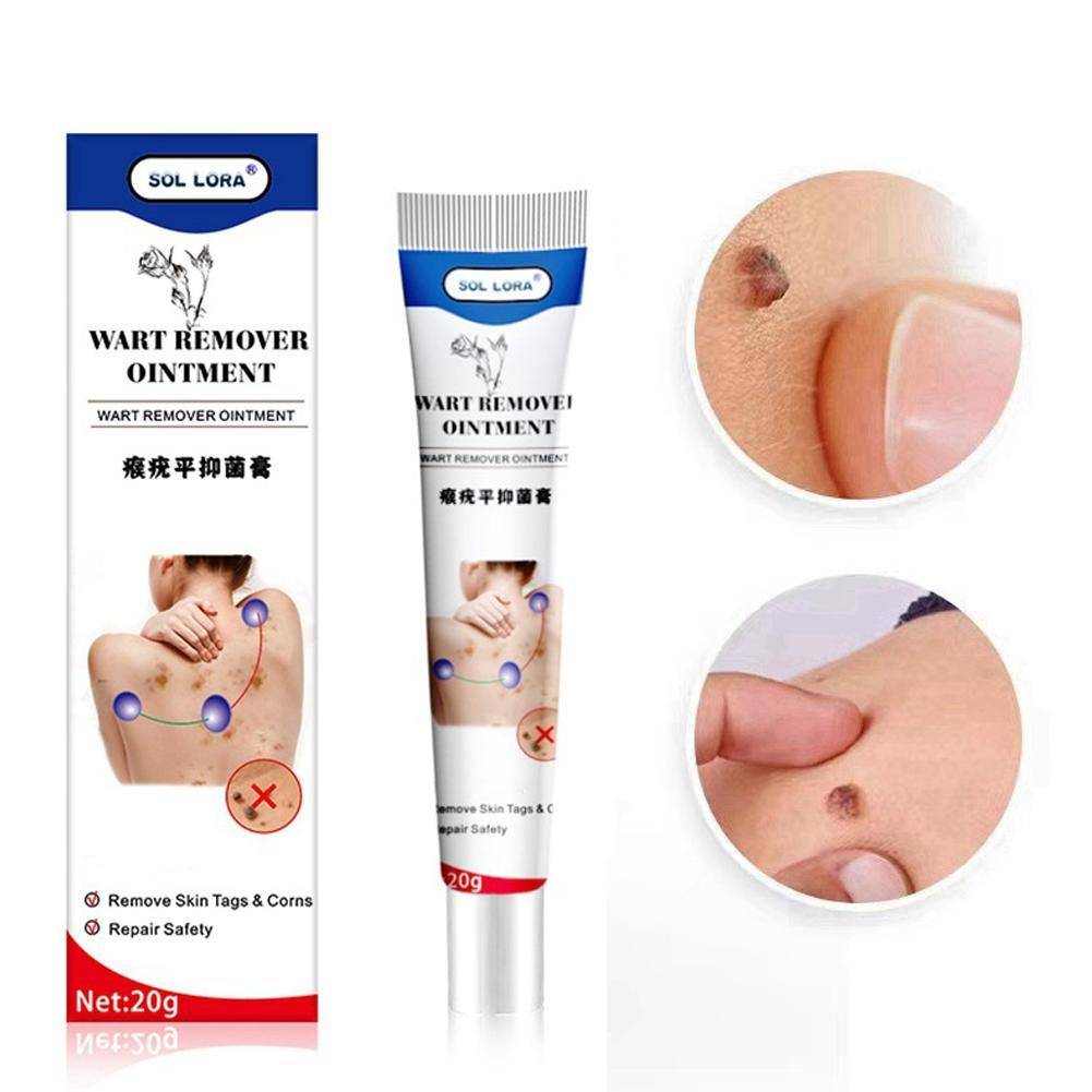 WartRemoval Cream 20g Pain-Free Solution for Sensitive Skin #4