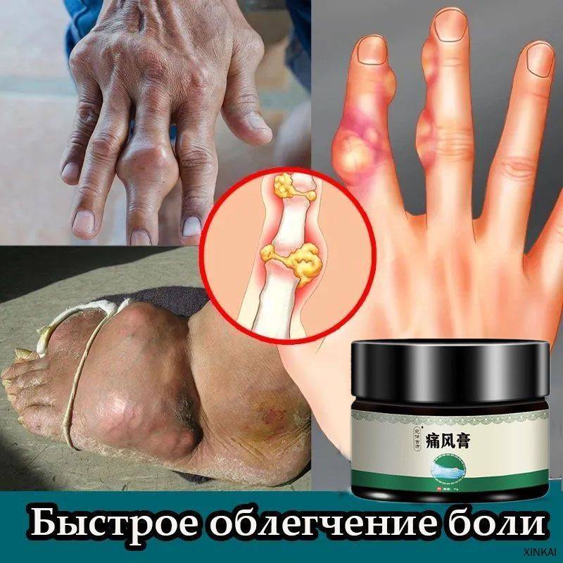 Topical Herbal Ointment Liquid Gel 35 ml