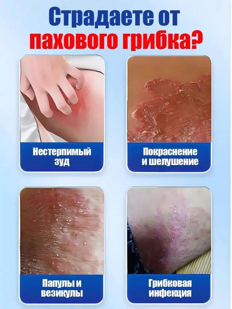 100 Herbs Health Balm for Skin Relief – Antifungal & Anti-inflammatory Treatment for Itching, Redness, and Irritation #3