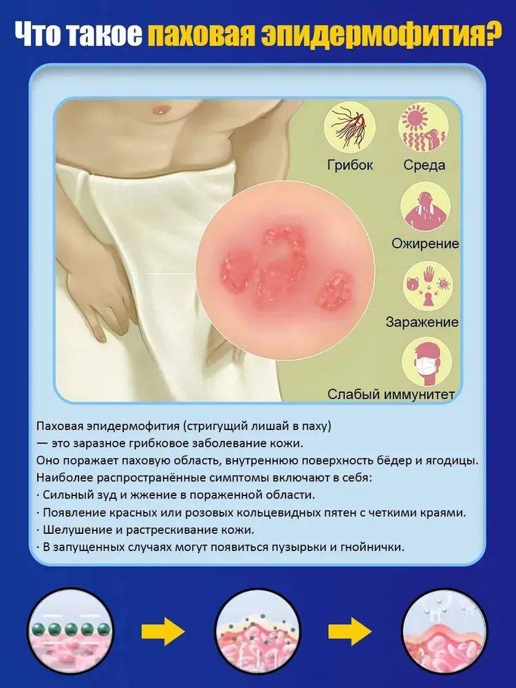 100 Herbs Health Balm for Skin Relief – Antifungal & Anti-inflammatory Treatment for Itching, Redness, and Irritation #5