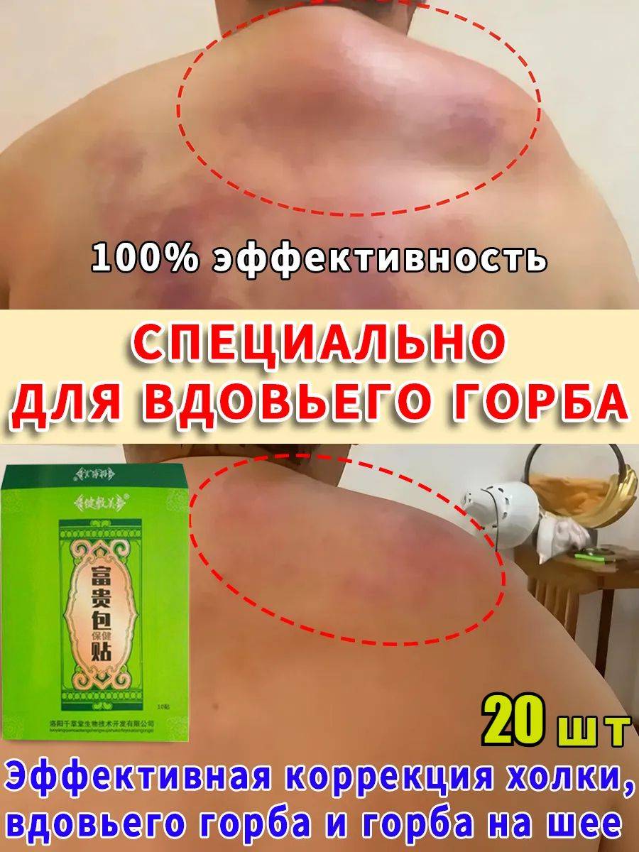 Neck Support Patches for Hump and Fat Deposits 10 Count