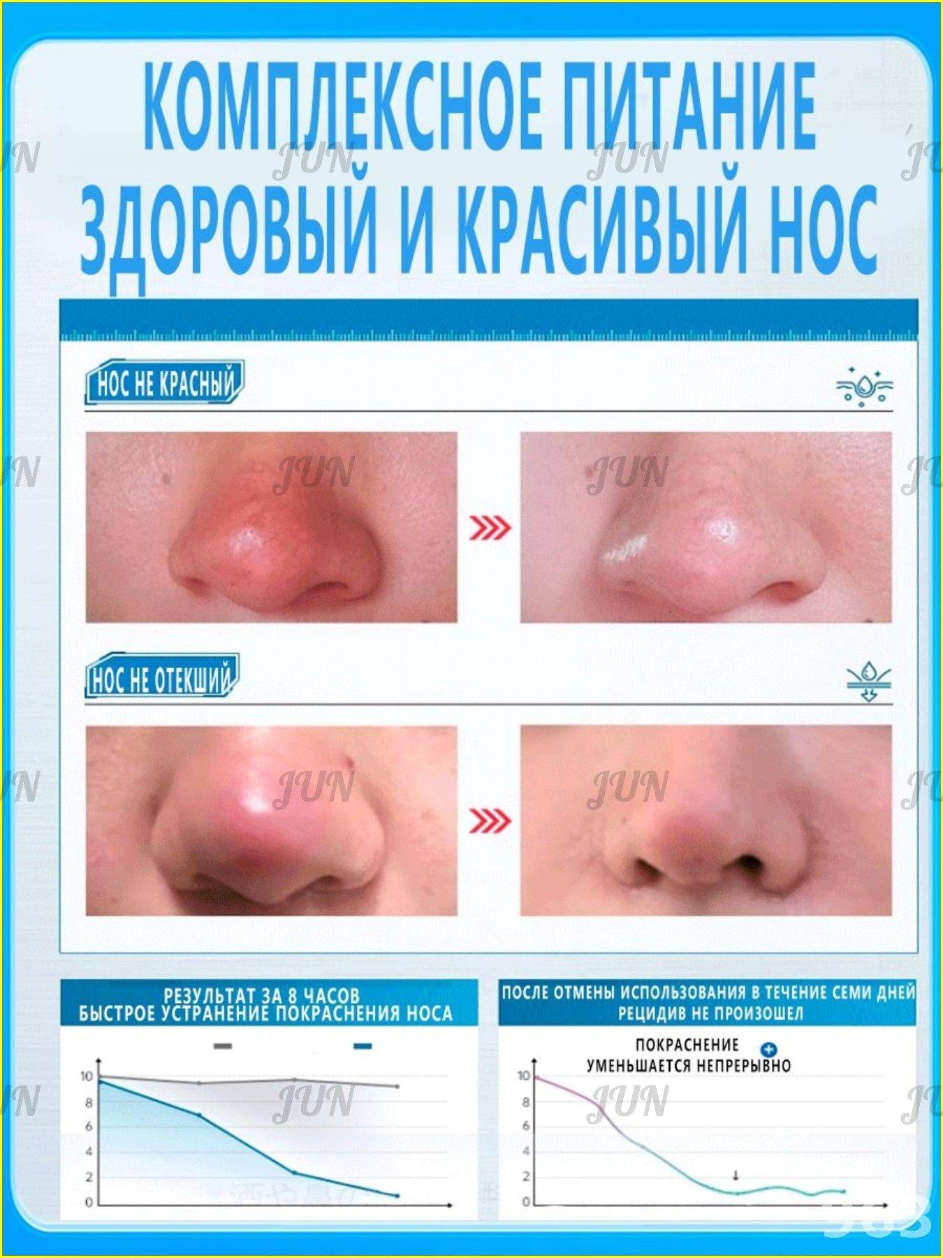 Therapeutic Cream for Rosacea, Dilated Capillaries, Oily Skin & Nasal Swelling - 30g #6