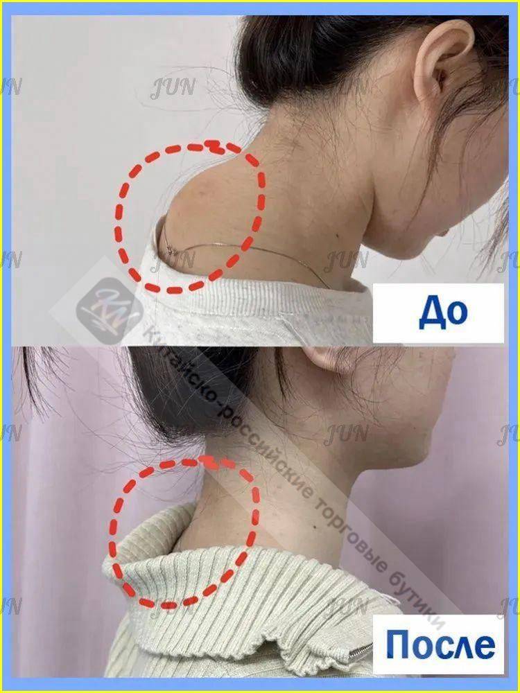 Therapeutic Patches for Cervical Spondylosis, Lumbar Spondylosis, Arthralgia, and Muscle Pain - 10 Count #6
