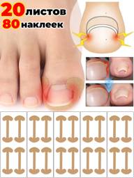 Ingrown Toenail Correction Patch Strips, 20 Sheets Patches #1