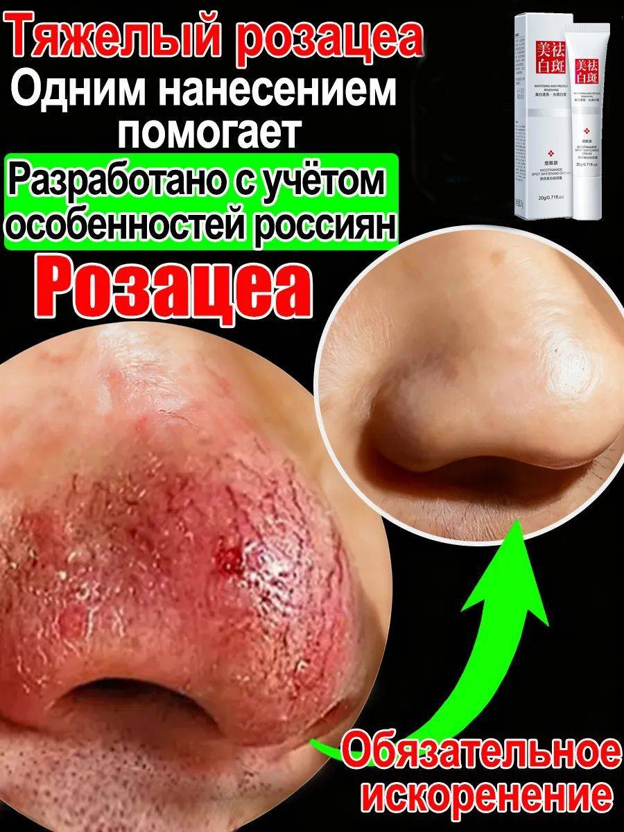 Cuperofag Facial Cream for Redness and Rosacea Care, 20 g