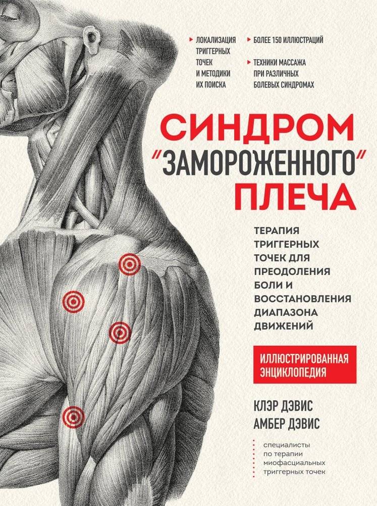 Синдром «замороженного» плеча. Терапия триггерных точек для преодоления боли и восстановления диапазона движений | Frozen Shoulder Syndrome: Trigger Point Therapy for Pain Relief and Range of Motion Restoration