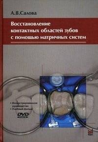 Восстановление контактных областей зубов с помощью матричных систем. Иллюстрированное руководство (+ DVD) | Restoration of Tooth Contact Areas Using Matrix Systems: An Illustrated Guide (+ DVD)