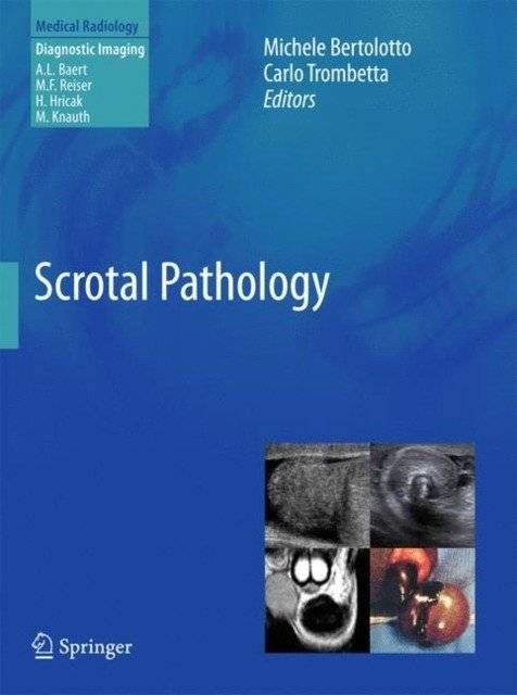 Патология мошонки | Scrotal Pathology