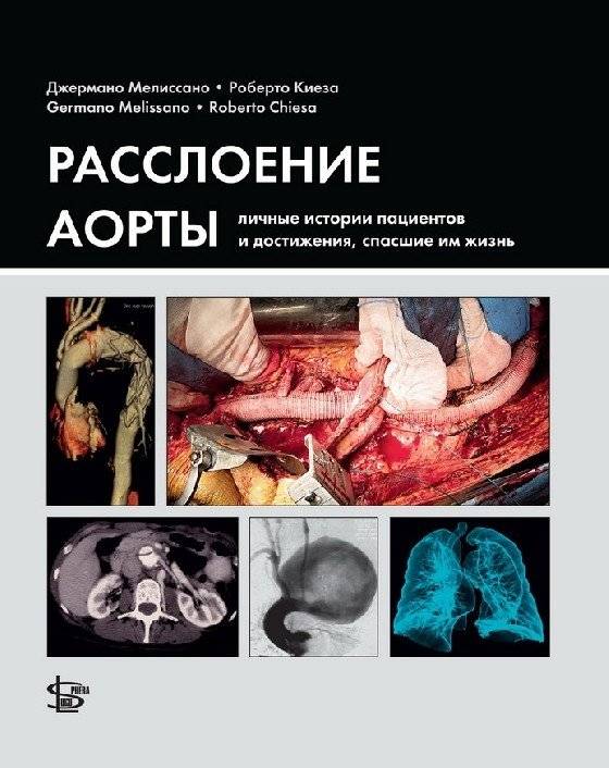 Расслоение аорты: личные истории пациентов и достижения, спасшие им жизнь | Aortic Dissection: Patient Stories and Life-Saving Advances