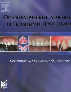 Ортопедическое лечение несъемными протезами | Orthopedic Treatment with Fixed Prostheses