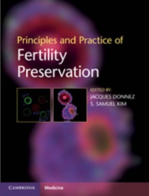 Principles and Practice of Fertility Preservation | Principles and Practice of Fertility Preservation
