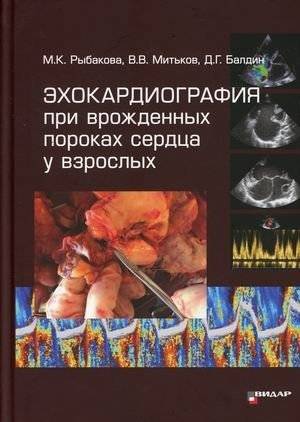 Эхокардиография при врожденных пороках сердца у взрослых | Echocardiography for Congenital Heart Defects in Adults