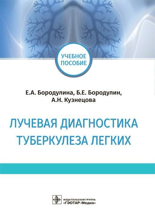 Лучевая диагностика туберкулеза легких | Radiological diagnosis of pulmonary tuberculosis