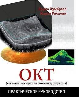 ОКТ (сетчатка, сосудистая оболочка, глаукома). Практическое руководство | OCT (Retina, Choroid, Glaucoma): A Practical Guide