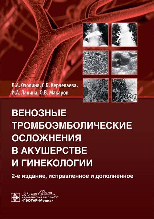 Венозные тромбоэмболические осложнения в акушерстве и гинекологии | Venous Thromboembolic Complications in Obstetrics and Gynecology