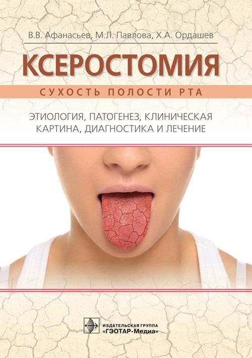 Ксеростомия (сухость полости рта). Этиология, патогенез, клиническая картина, диагностика и лечение | Xerostomia (Dry Mouth): Etiology, Pathogenesis, Clinical Presentation, Diagnosis, and Treatment