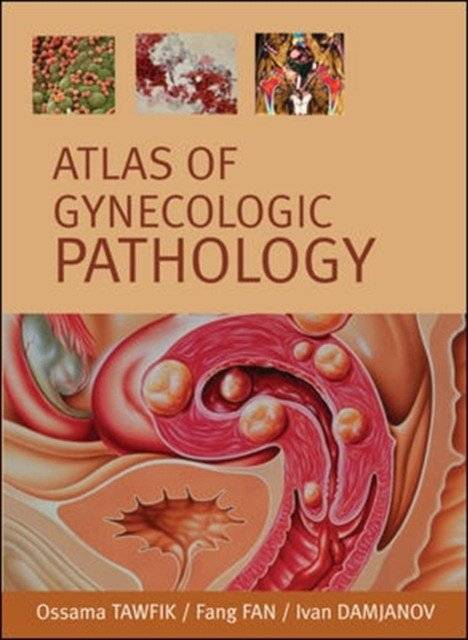Атлас гинекологической патологии | Atlas of Gynecological Pathology