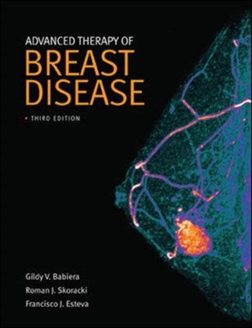 Advanced therapy of breast disease | Advanced Therapy of Breast Disease