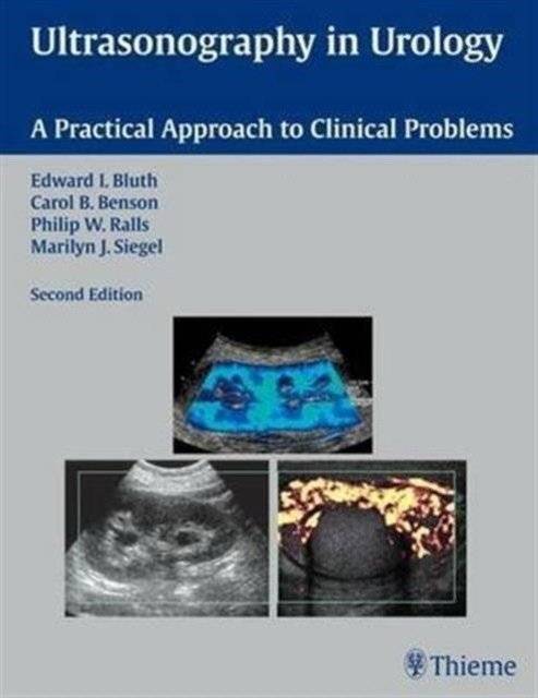 Ультразвуковая диагностика в урологии | Ultrasonography in Urology