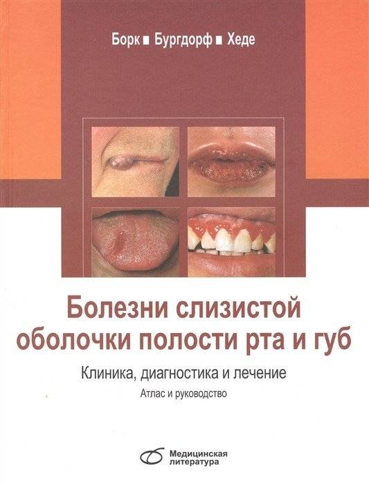 Болезни слизистой оболочки полости рта и губ. Клиника, диагностика и лечение. Атлас и руководство | Diseases of the Oral Mucosa and Lips: Clinic, Diagnosis, and Treatment. Atlas and Guide