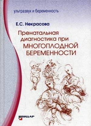 Пренатальная диагностика при многоплодной беременности. Руководство | Prenatal Diagnosis in Multiple Pregnancy: A Guide