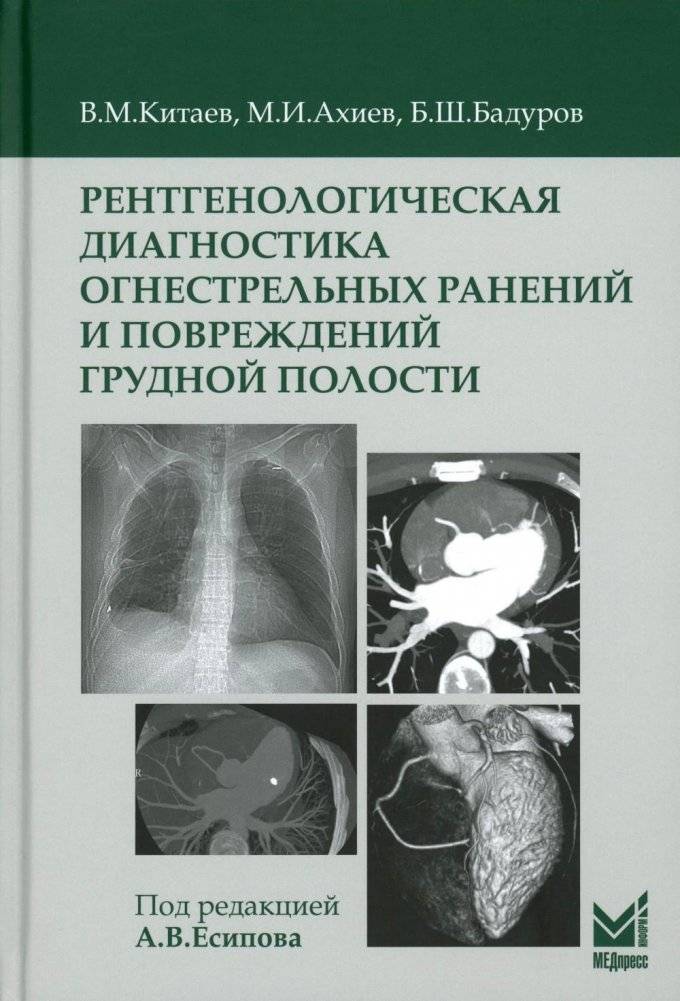 Рентгенологическая диагностика огнестрельных ранений и повреждений грудной полости | Radiological Diagnostics of Gunshot Wounds and Chest Injuries