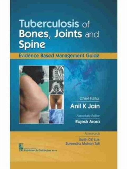 Туберкулез костей, суставов и позвоночника (Hb 2017) | Tuberculosis of Bones, Joints, and Spine (Hb 2017)