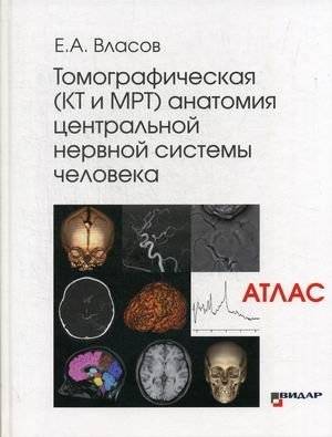 Томографическая (КТ и МРТ) анатомия центральной нервной системы человека. Атлас | Tomographic Anatomy of the Human Central Nervous System (CT and MRI): An Atlas
