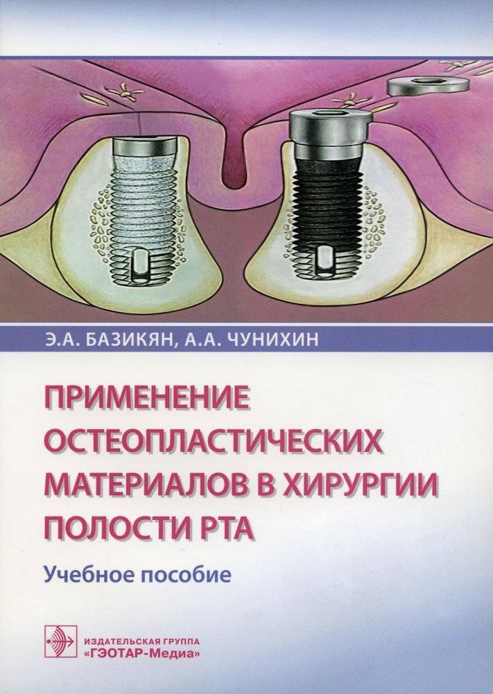Применение остеопластических материалов в хирургии полости рта. Учебное пособие | Application of Osteoplastic Materials in Oral Surgery: A Textbook