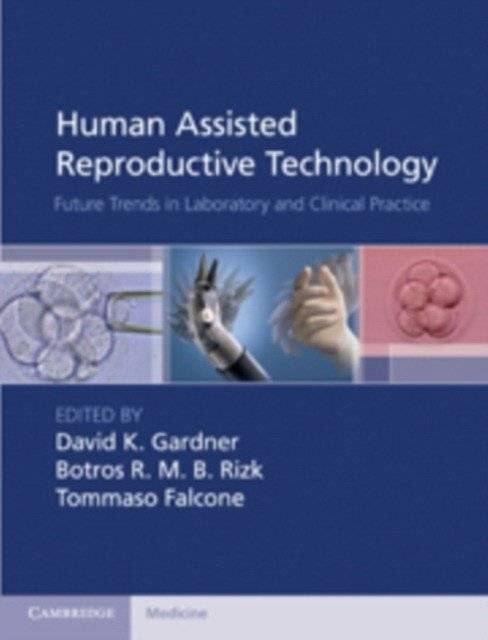 Human Assisted Reproductive Technology | Human Assisted Reproductive Technology