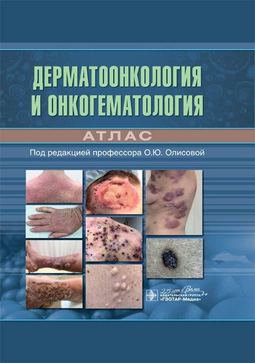 Дерматоонкология и онкогематология. Атлас | Dermatooncology and Oncohematology: An Atlas