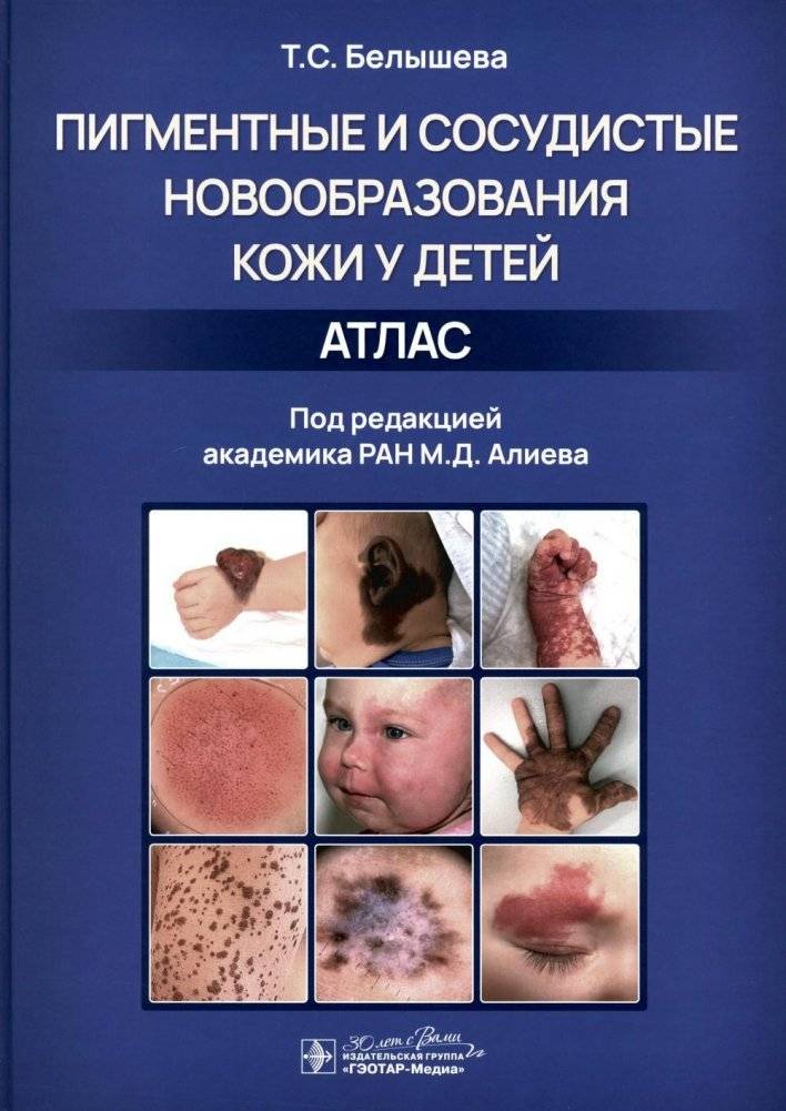 Пигментные и сосудистые новообразования кожи у детей. Атлас | Pigmented and Vascular Skin Neoplasms in Children: An Atlas