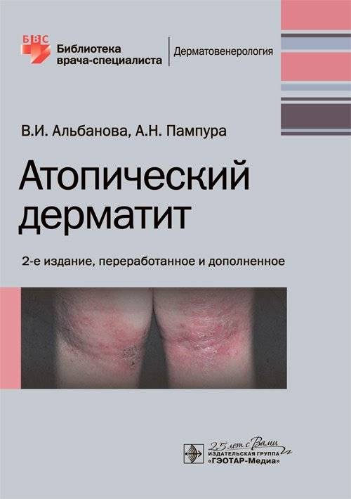Атопический дерматит | Atopic Dermatitis