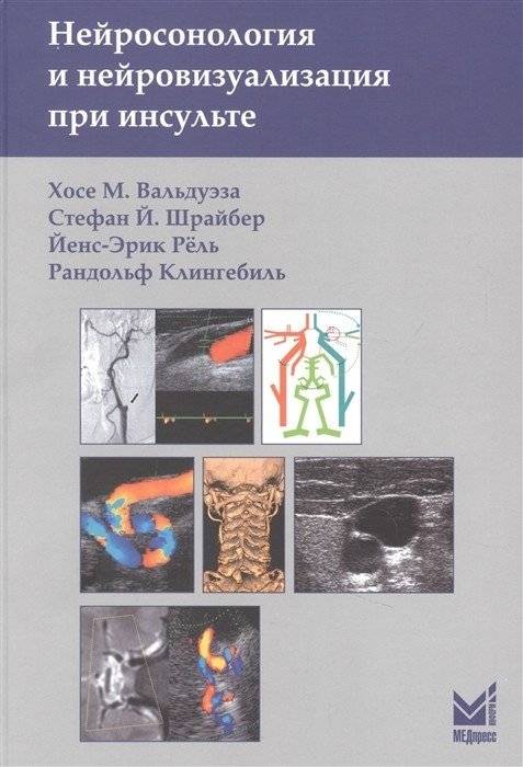 Нейросонология и нейровизуализация при инсульте | Neurosonology and Neuroimaging in Stroke