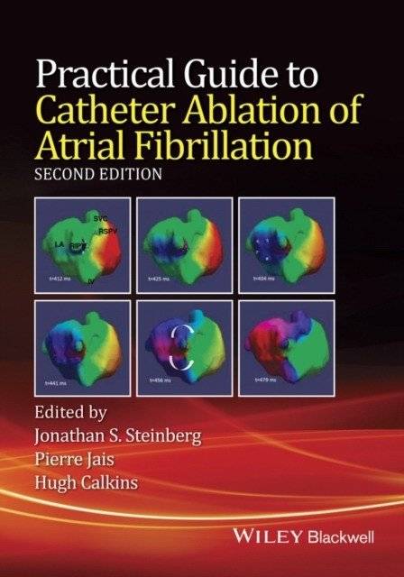 Практическое руководство по катетерной абляции фибрилляции предсердий | Practical Guide to Catheter Ablation of Atrial Fibrillation